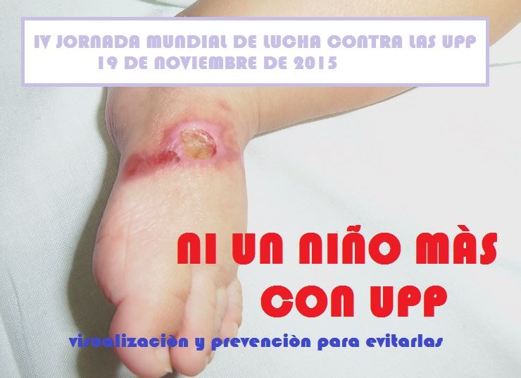 UPP pediatría y otras heridas | Por el cuidado excelente de la infancia con  heridas
